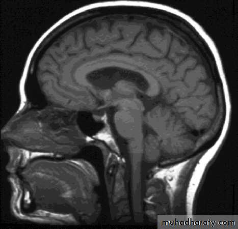 introducing cross sectional imaging pptx احمد سعيد Muhadharaty