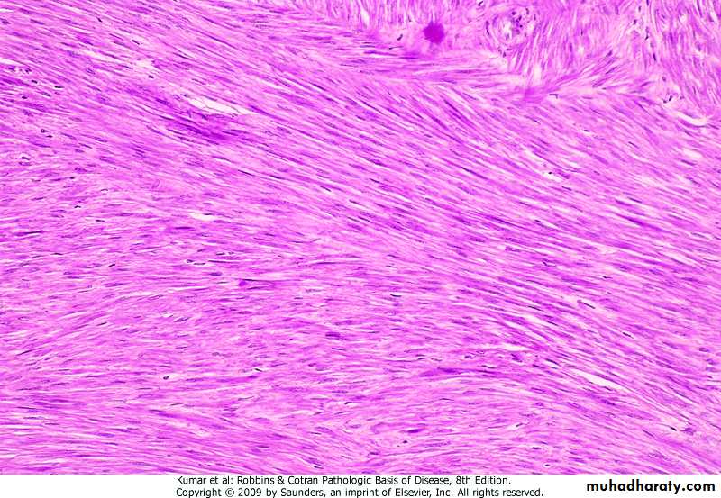 Oncology pptx - د.شعيب - Muhadharaty