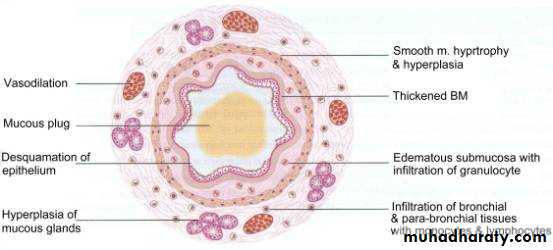 Asthma Pptx - Mohammed Waheeb - Muhadharaty