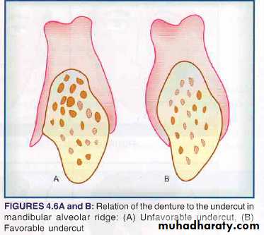 complete denture pptx - unkown - Muhadharaty