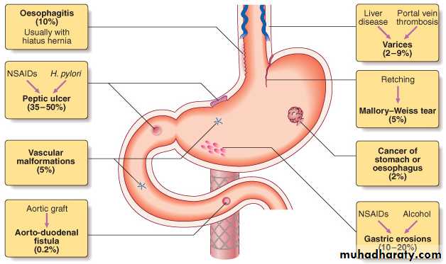 upper GI bleeding docx - دكتور حسن اسماعيل - Muhadharaty