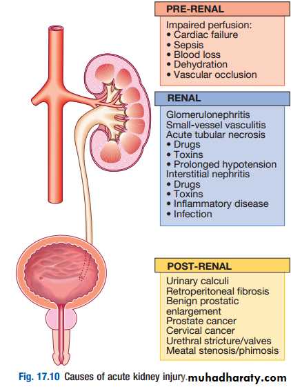 presentations of kidney injury