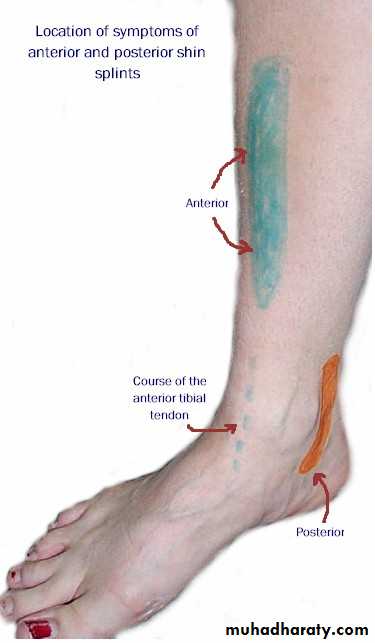 Regional Periarticular Pain pptx - د.سامي سلمان - Muhadharaty