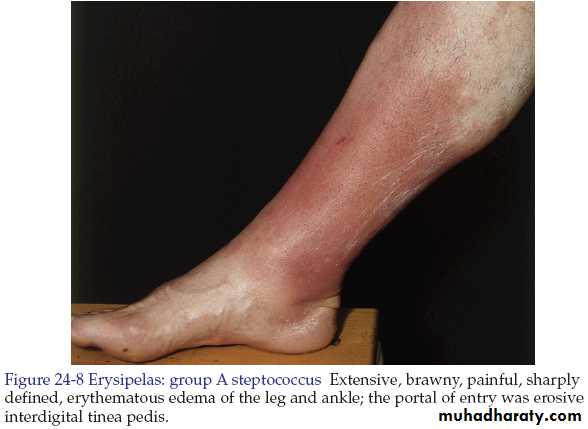 Bacterial skin infections pptx - د.سلام التميمي - Muhadharaty