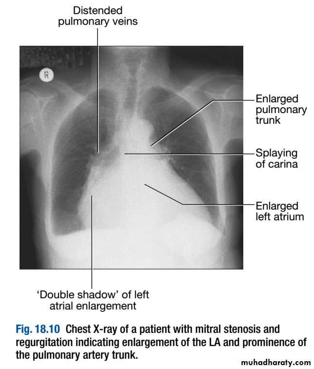 INVESTIGATION OF CARDIOVASCULAR SYSTEM pptx - د.عادل الحسيني - Muhadharaty