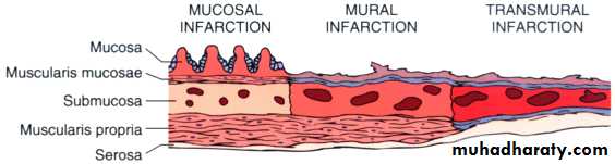 Pathology of GIT- Intestine pptx - Prof Dr Faeza Aftan - Muhadharaty