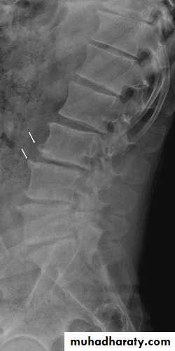 Musculoskeletal pptx - د.هديل - Muhadharaty