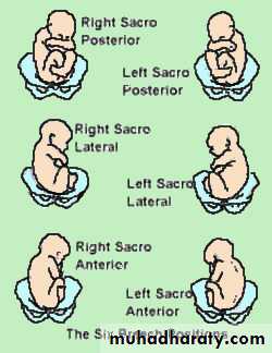 Breech Presentation Pptx - د. أسماء - Muhadharaty