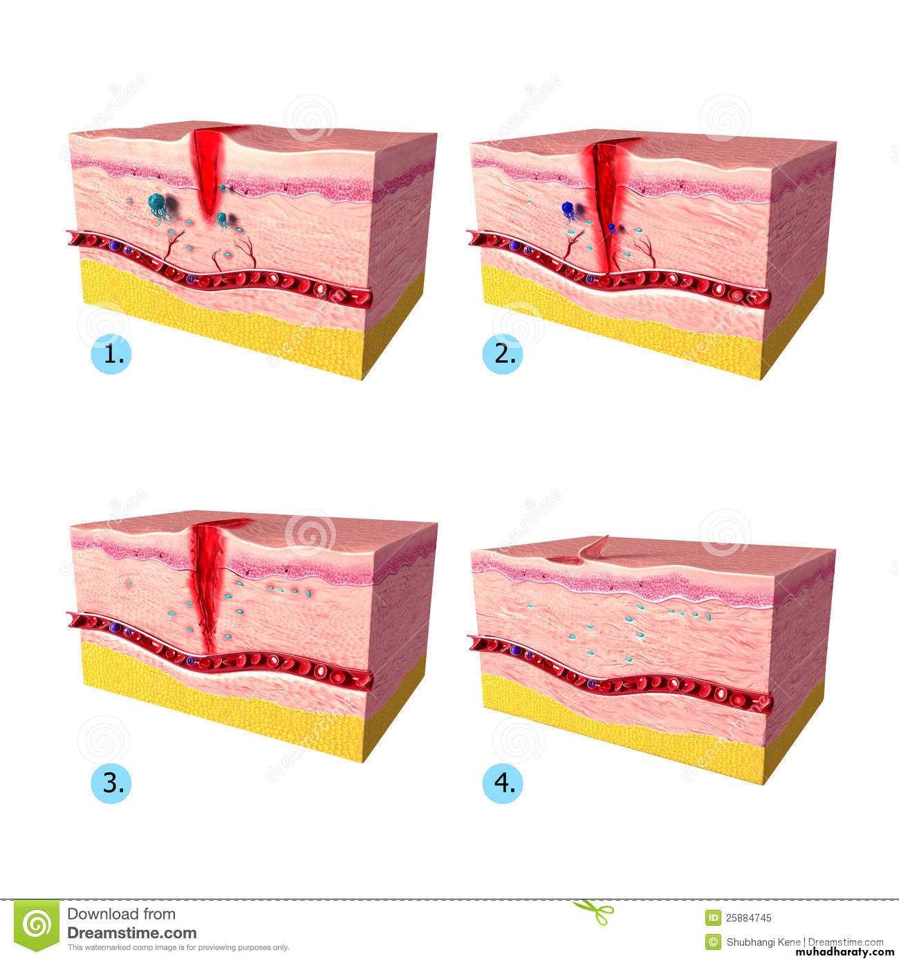 Inflamations pptx - د.جاسم الابراهيمي - Muhadharaty