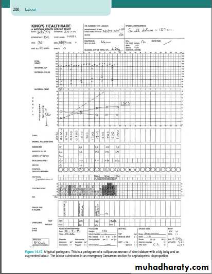 management of normal labour docx - د.ولدان - Muhadharaty