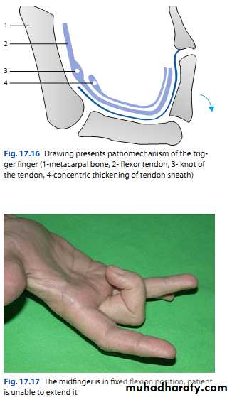 Upper limbs orthopedic pptx - د. مثنى - Muhadharaty