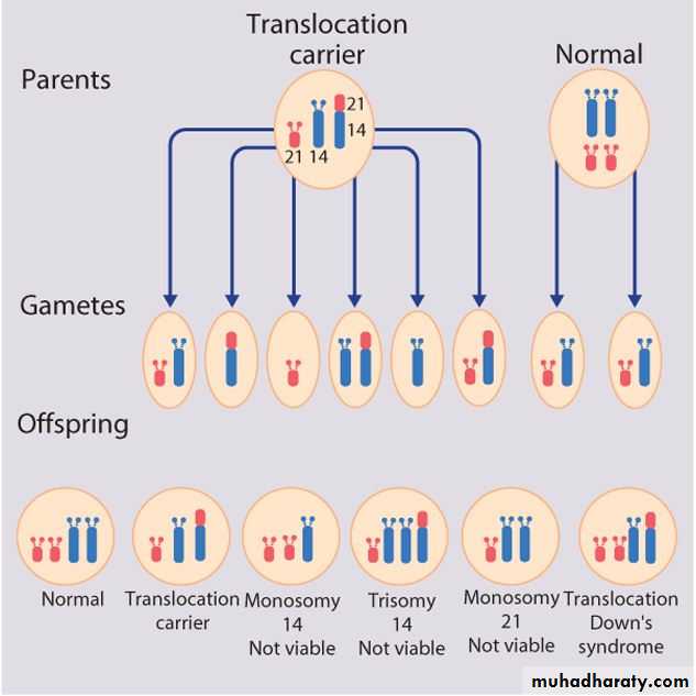 Генотип 16 45. Робертсоновская транслокация 21 хромосомы. Robertsonian translocation. Робертсоновские транслокации при синдроме Дауна. Несбалансированная транслокация.