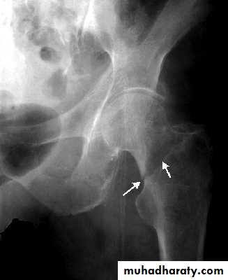 Lower limbs pptx - د.هشام القطان - Muhadharaty