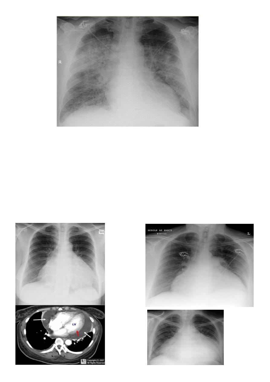 Mediastinum and heart pdf - د. زهراء - Muhadharaty