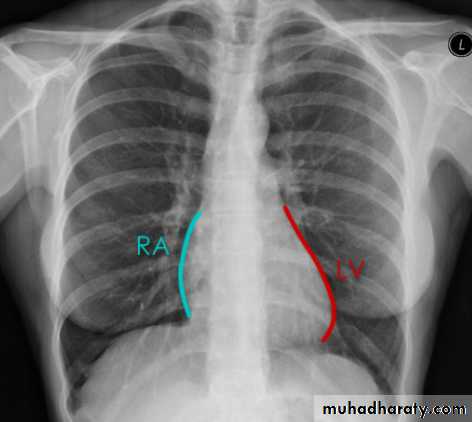 Practical Chest pptx - د.هديل - Muhadharaty