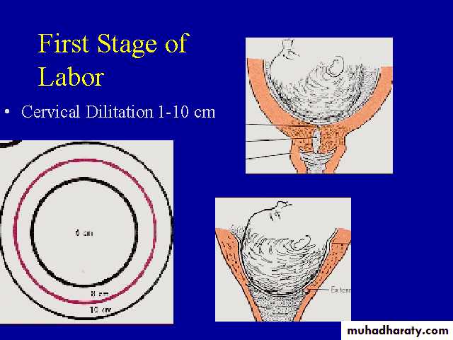 Induction Of Labour Pptx داحمد جاسم Muhadharaty 