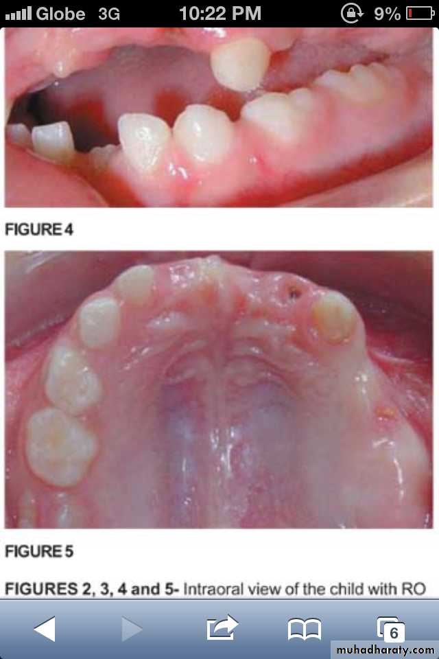 Dental anomalies pptx - Dr.Rand Al-Ani - Muhadharaty