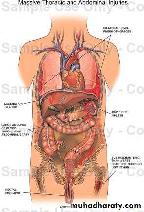 Расположение органов у человека в брюшной полости фото