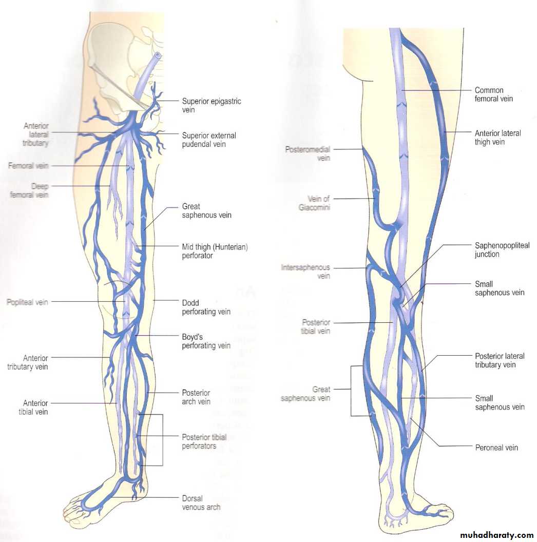 Diseases Of Viens Pptx - غير معروف - Muhadharaty