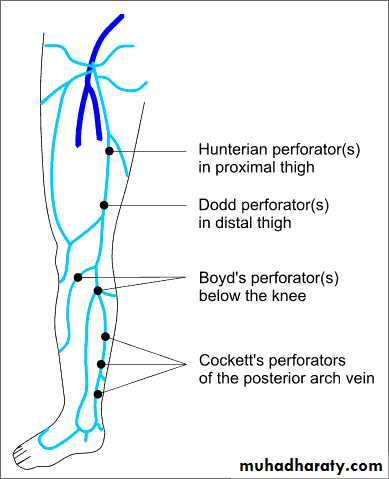 Diseases of viens pptx - غير معروف - Muhadharaty