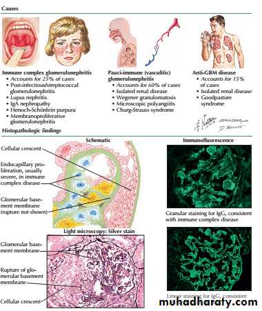 Glomerular disease pptx - د. علي الساعدي - Muhadharaty