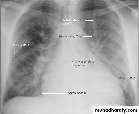 Renal pptx - د. حسين محمد جمعة - Muhadharaty