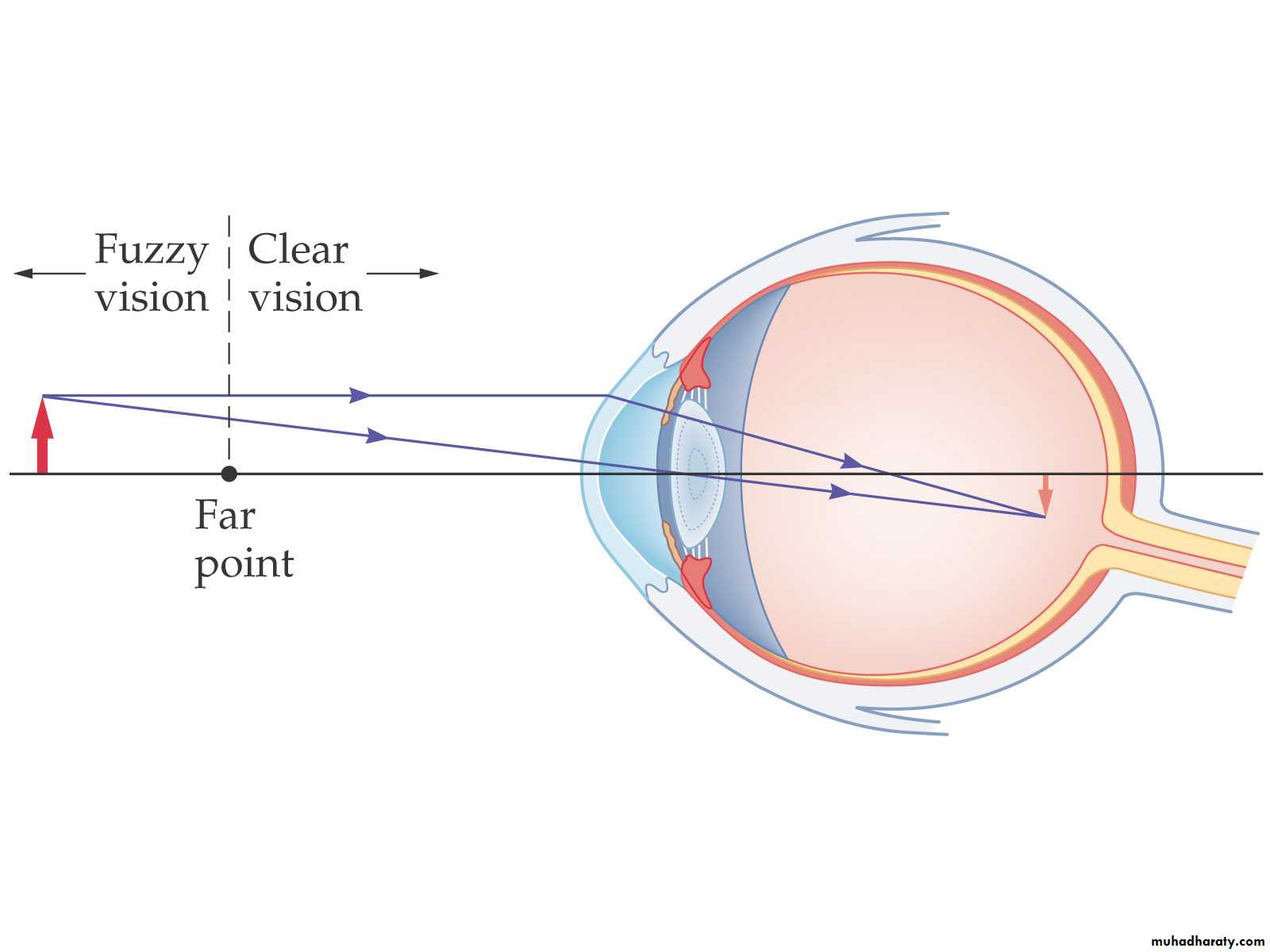 light in medicine ppt pptx - د.تيماء - Muhadharaty