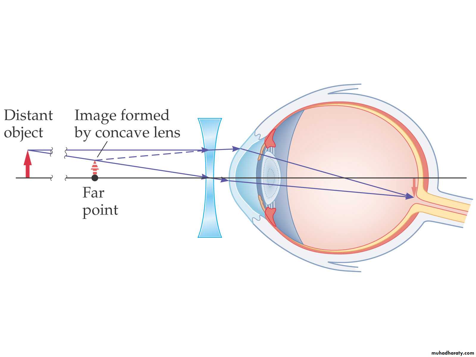 light in medicine ppt pptx - د.تيماء - Muhadharaty