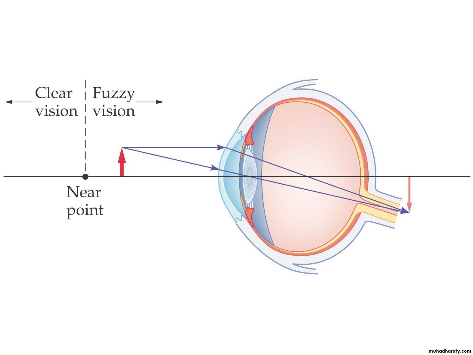 light in medicine ppt pptx - د.تيماء - Muhadharaty