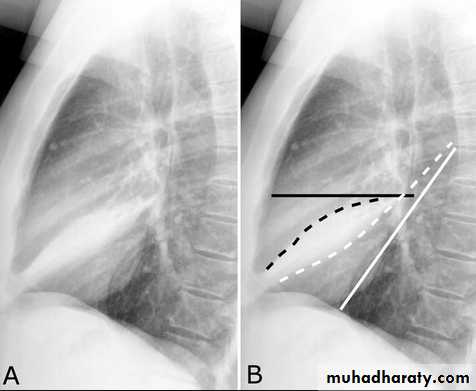 chest practice pptx - د.احمد - Muhadharaty