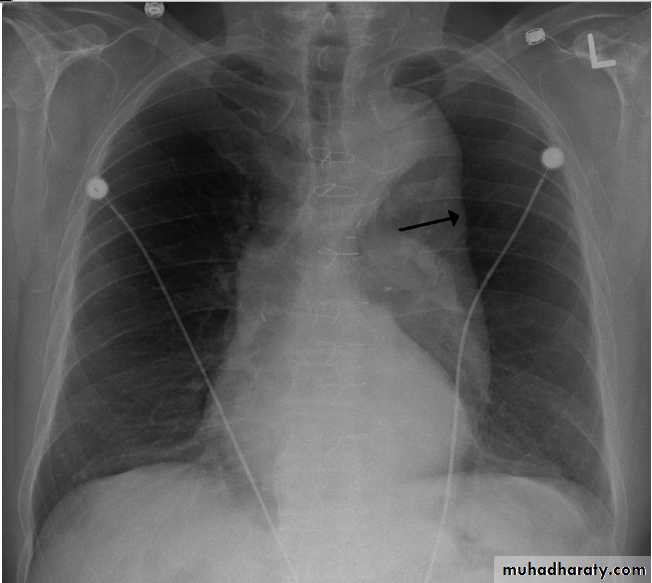 chest practice pptx - د.احمد - Muhadharaty