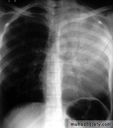 chest practice pptx - د.احمد - Muhadharaty