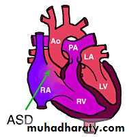 Acynotic congenital heart disease pptx - د.منيرة - Muhadharaty