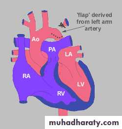 Cynotic congenital heart disease pptx - د.منيرة - Muhadharaty