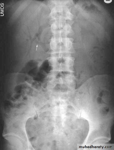 Imaging of GIT diseases pptx - غير معروف - Muhadharaty