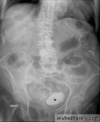 Imaging of GIT diseases pptx - غير معروف - Muhadharaty