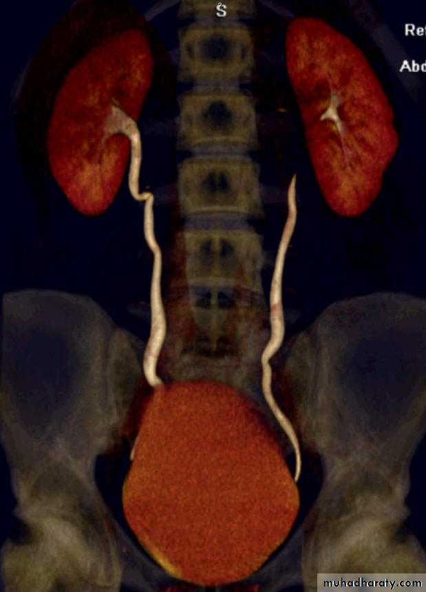 Imaging Of Urinary Tract Diseases Pptx - غير معروف - Muhadharaty