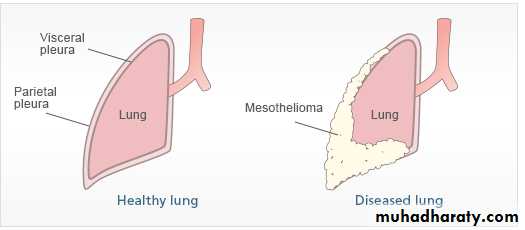 The pleura and chest tube and thoracoscopy pptx - غير معروف - Muhadharaty