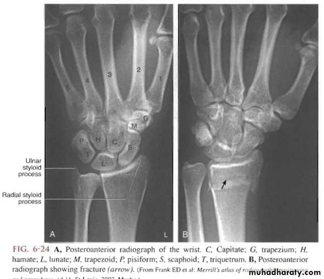 Upper limbs pptx - د. مثنى - Muhadharaty