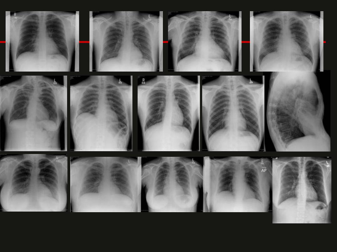 Interpretation of chest CT and X ray pdf - عملي - Muhadharaty