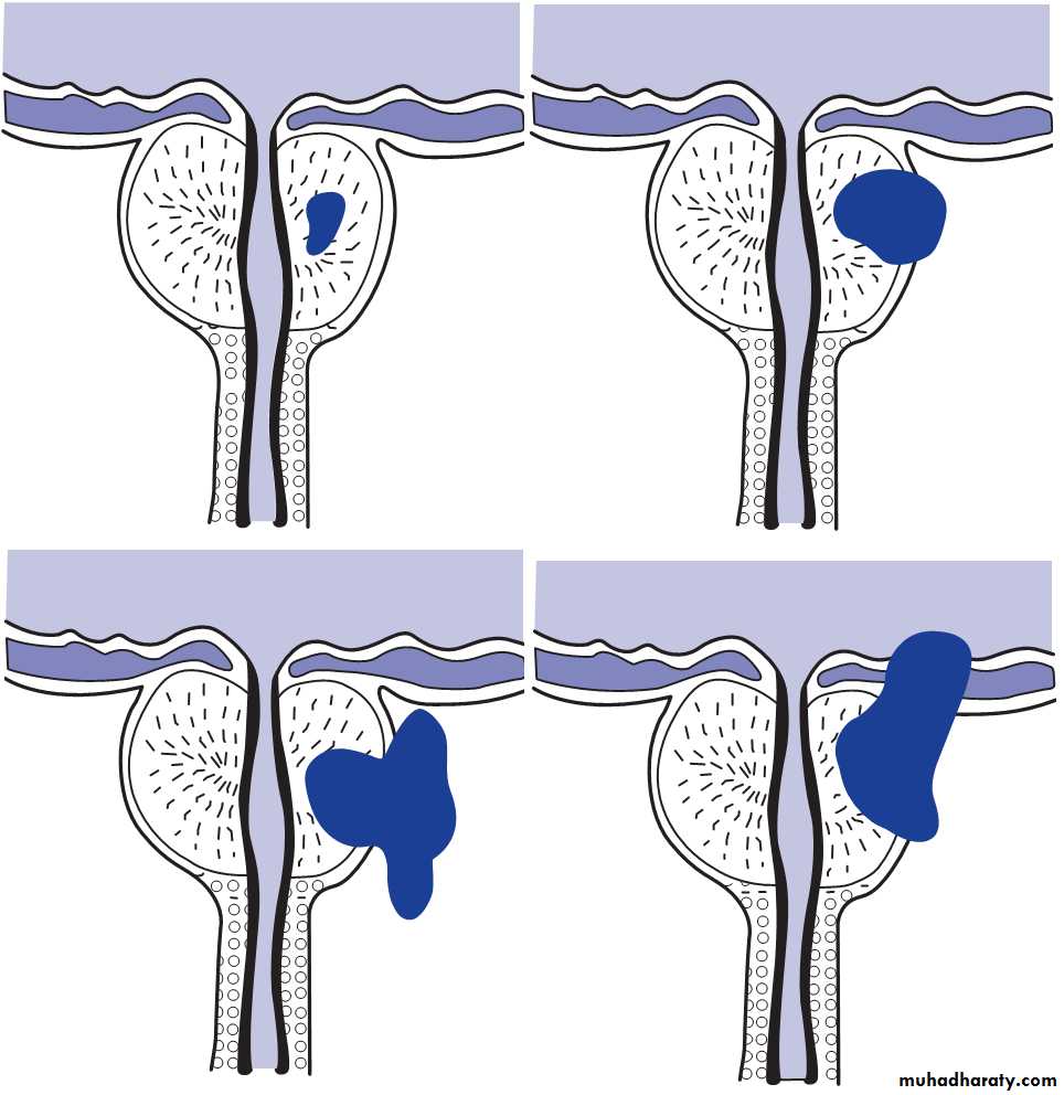 The Prostate And Seminal Vesicles 2 Pptx - نظري - Muhadharaty