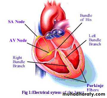 arrhythmia Disorders of heart Rate and rhythm and conduction pptx ...