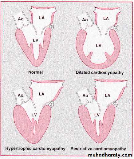 Diseases of the myocardium pptx - Cardiovascular system - Muhadharaty