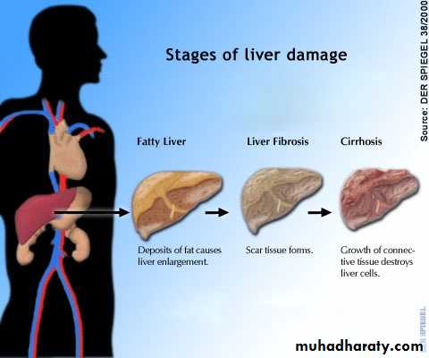 Patterns of hepatic injury pptx - Liver and Biliary tract - Muhadharaty