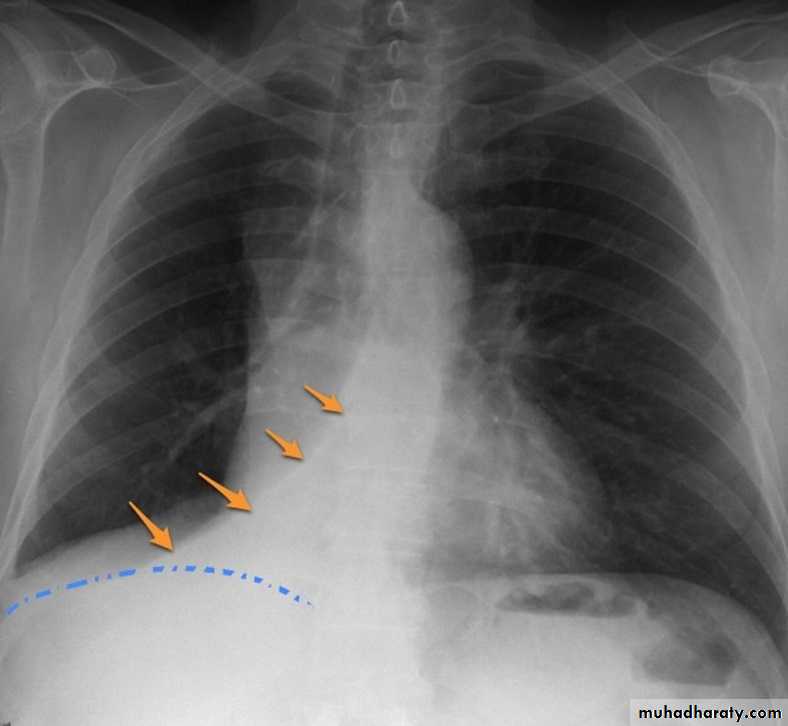 Chest Imaging docx - Chest Imaging - Muhadharaty