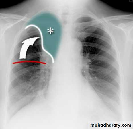 Chest Imaging docx - Chest Imaging - Muhadharaty