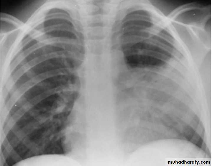 Respiratory system pptx - د. أثل - Muhadharaty