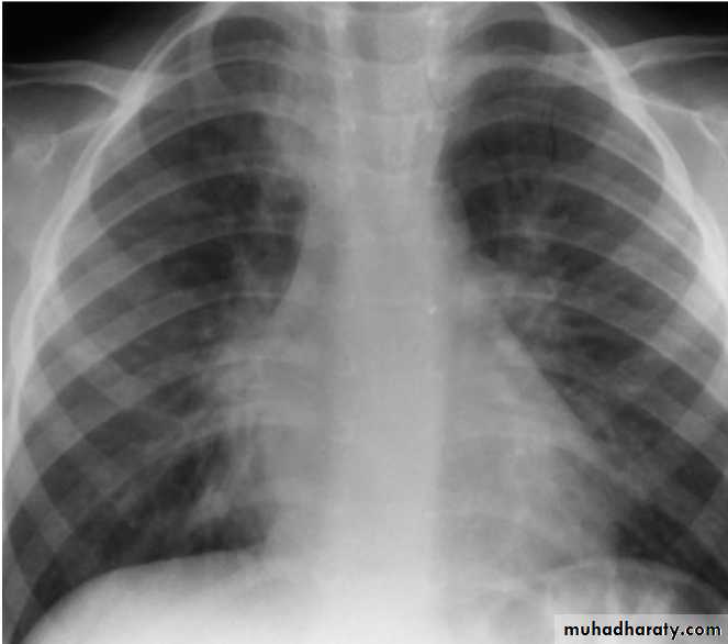 Respiratory system pptx - د. أثل - Muhadharaty