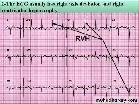 Cyanotic Congenital Heart Disease docx - د.خليل - Muhadharaty