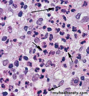 inflammation-lab docx - ا.اسماعيل - Muhadharaty